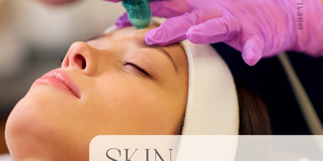 best microdermabrasion in dallas