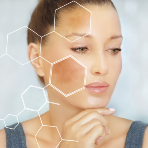 dark spots and pigmentation treatments in dallas