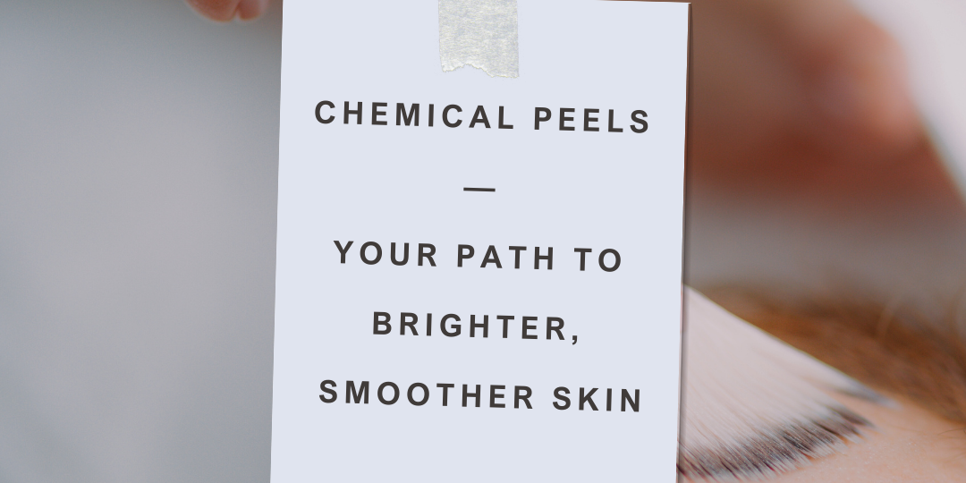 chemical peels